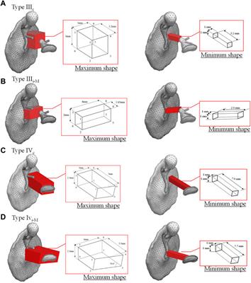 Mechanical effect of reconstructed shapes of autologous ossicles on middle ear acoustic transmission